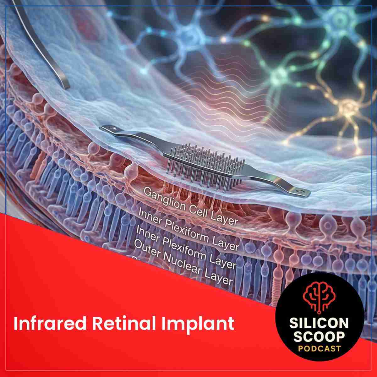 This Retinal Implant Lets Humans See Near-infrared
